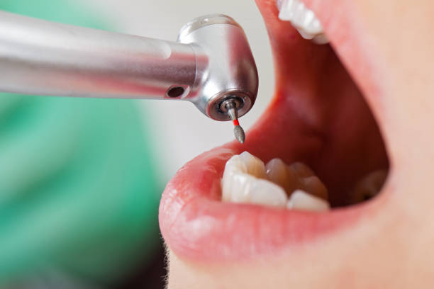 Best Emergency Treatment for Dental Infections or Abscesses in Richlands, NC